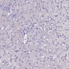 Immunohistochemical staining of human liver shows no positivity in hepatocytes as expected.