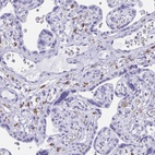 Anti-ZNF850 Antibody