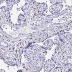 Anti-ZNF850 Antibody