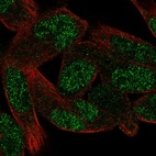 Immunofluorescent staining of human cell line RH-30 shows localization to nucleoplasm.