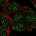 Immunofluorescent staining of human cell line RH-30 shows localization to nucleoplasm.