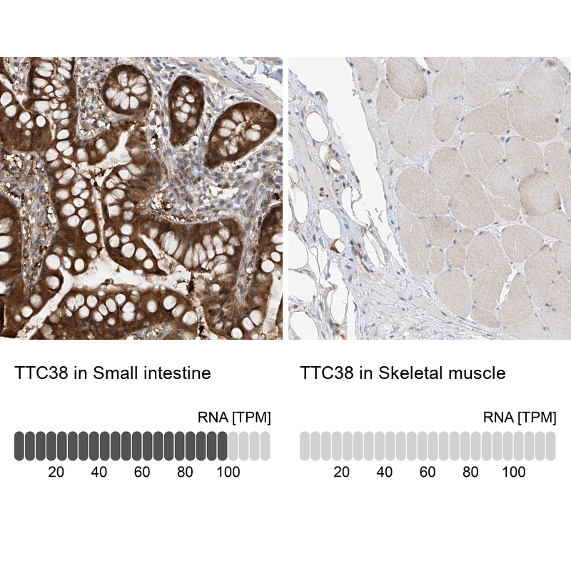 Anti-TTC38 Antibody