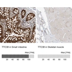 Anti-TTC38 Antibody