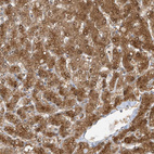 Immunohistochemical staining of human liver shows strong cytoplasmic positivity in hepatocytes.