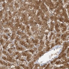Immunohistochemical staining of human liver shows strong cytoplasmic positivity in hepatocytes.
