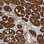 Immunohistochemical staining of human kidney shows strong cytoplasmic positivity in cells in tubules.