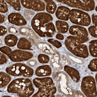 Immunohistochemical staining of human kidney shows strong cytoplasmic positivity in cells in tubules.
