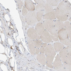 Immunohistochemical staining of human skeletal muscle shows no cytoplasmic positivity in myocytes as expected.