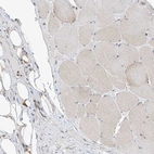 Immunohistochemical staining of human skeletal muscle shows no cytoplasmic positivity in myocytes as expected.