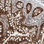 Immunohistochemical staining of human small intestine shows strong cytoplasmic positivity in glandular cells.
