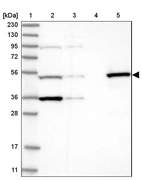 Lane 1: Marker [kDa] 230, 130, 95, 72, 56, 36, 28, 17, 11_br/_Lane 2: Human cell line RT-4_br/_Lane 3: Human cell line U-251MG sp_br/_Lane 4: Human plasma (IgG/HSA depleted)_br/_Lane 5: Human liver tissue