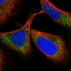 Immunofluorescent staining of human cell line U-2 OS shows localization to cytosol.
