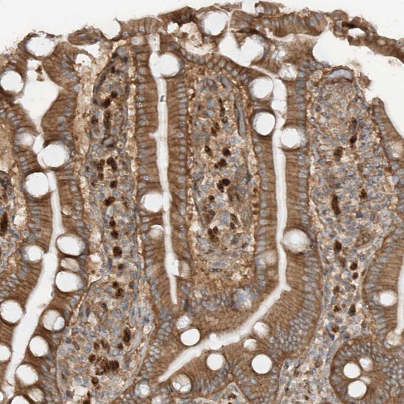 Anti-SDCCAG3 Antibody