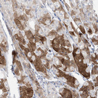 Immunohistochemical staining of human stomach shows moderate cytoplasmic positivity in glandular cells.