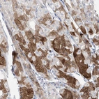 Immunohistochemical staining of human stomach shows moderate cytoplasmic positivity in glandular cells.