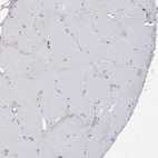 Immunohistochemical staining of human skeletal muscle shows weak cytoplasmic positivity in myocytes.
