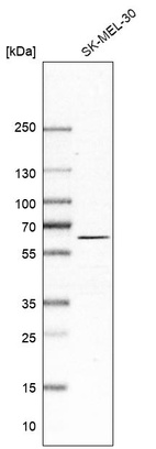 Western blot analysis in human cell line SK-MEL-30.