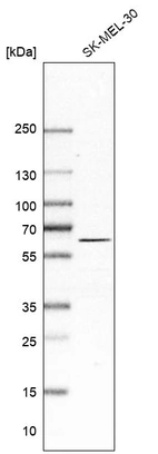 Western blot analysis in human cell line SK-MEL-30.