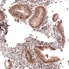 Immunohistochemical staining of human endometrium shows moderate nuclear positivity in glandular cells.
