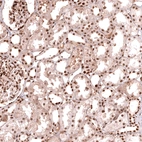 Immunohistochemical staining of human kidney shows strong nuclear positivity in cells in tubules.