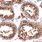 Immunohistochemical staining of human testis shows strong nuclear positivity in cells in seminiferous ducts.