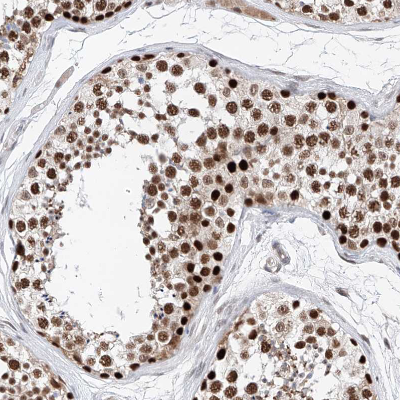 Anti-SNRNP200 Antibody