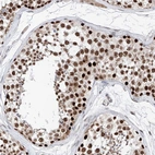 Anti-SNRNP200 Antibody