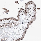 Immunohistochemical staining of human placenta shows strong nuclear positivity in trophoblastic cells.