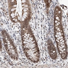 Immunohistochemical staining of human colon shows strong nuclear positivity in glandular cells.