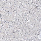 Immunohistochemical staining of human liver shows no positivity in hepatocytes as expected.