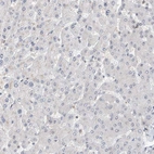 Immunohistochemical staining of human liver shows no positivity in hepatocytes as expected.