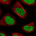 Immunofluorescent staining of human cell line U-2 OS shows localization to nucleoplasm.