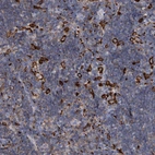Immunohistochemical staining of human lymph node shows membranous positivity in lymphoid cells.