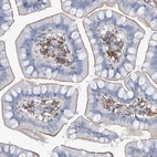 Immunohistochemical staining of human small intestine shows positivity in lymphoid cells.