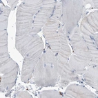 Immunohistochemical staining of human skeletal muscle shows no positivity in myocytes as expected.