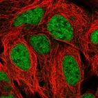 Immunofluorescent staining of human cell line HEK 293 shows localization to nucleoplasm.