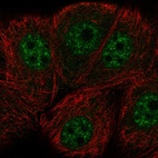 Anti-ERCC8 Antibody