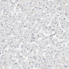 Immunohistochemical staining of human liver shows no nuclear positivity in hepatocytes as expected.
