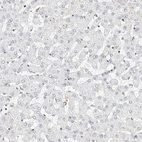 Immunohistochemical staining of human liver shows no nuclear positivity in hepatocytes as expected.