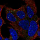 Anti-TBX1 Antibody