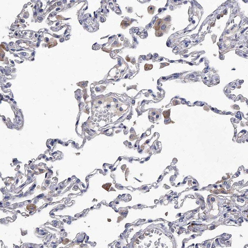 Anti-C5 Antibody