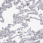 Anti-C5 Antibody