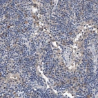 Immunohistochemical staining of human lymph node shows moderate cytoplasmic positivity in lymphoid cells.