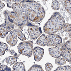 Immunohistochemical staining of human placenta shows moderate positivity in plasma.