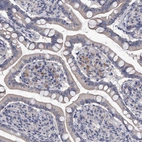 Immunohistochemical staining of human small intestine shows moderate cytoplasmic positivity in lymphoid cells.