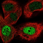 Immunofluorescent staining of human cell line A-431 shows localization to nucleoplasm.