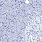 Anti-CCT4 Antibody