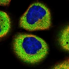 Immunofluorescent staining of human cell line A-431 shows localization to cytosol.