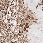Anti-ATP9B Antibody