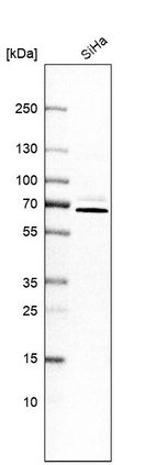 Western blot analysis in human cell line SiHa.